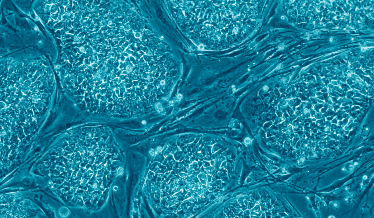 Human_embryonic_stem_cells_only_A