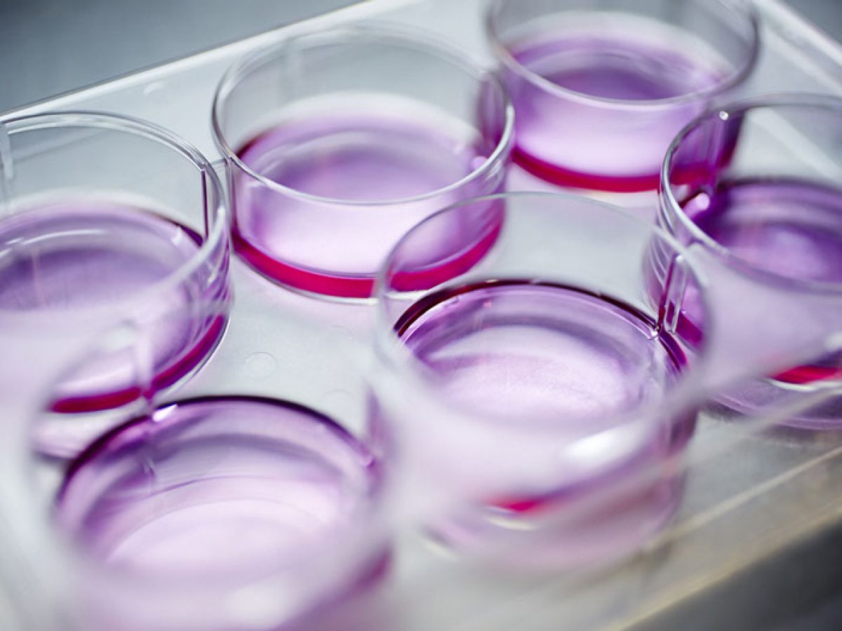 img-antibodies-6