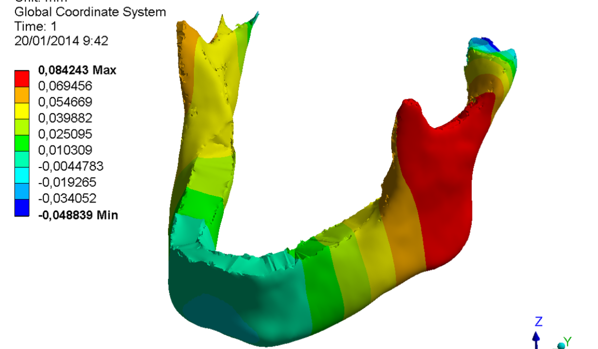 mandible